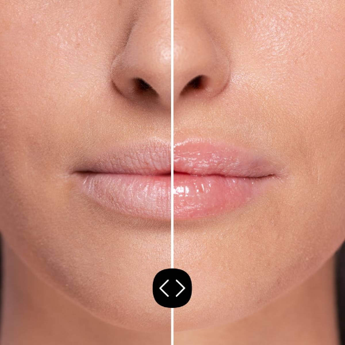 Volumateur pour les lèvres hyaluronique Freshly 5 ml