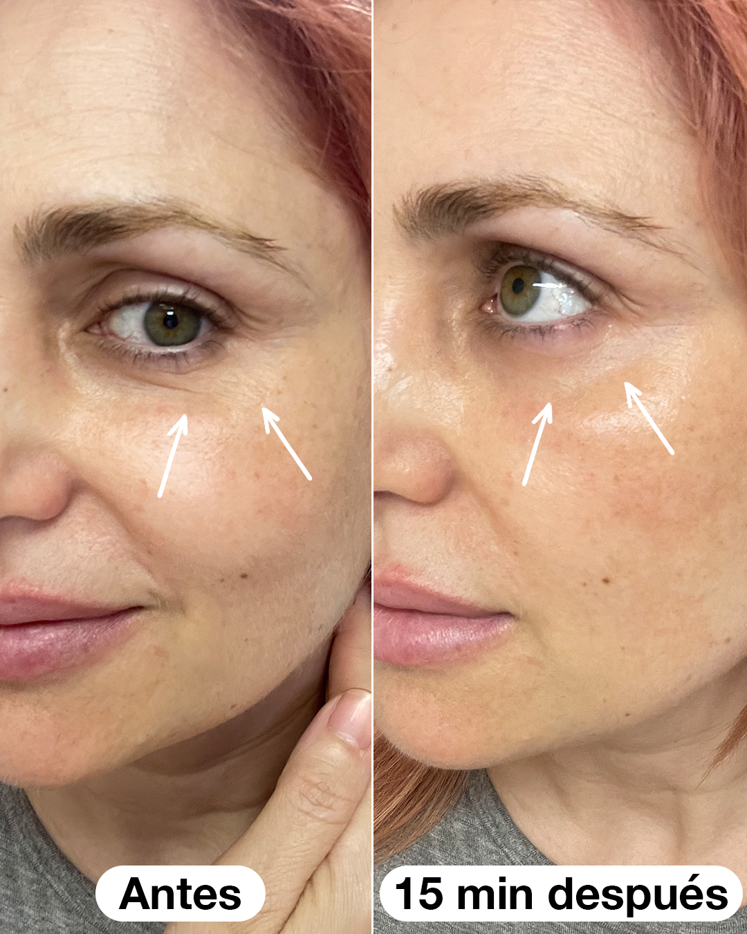 Roll-on-Serum Eye Salad Code 10 ml