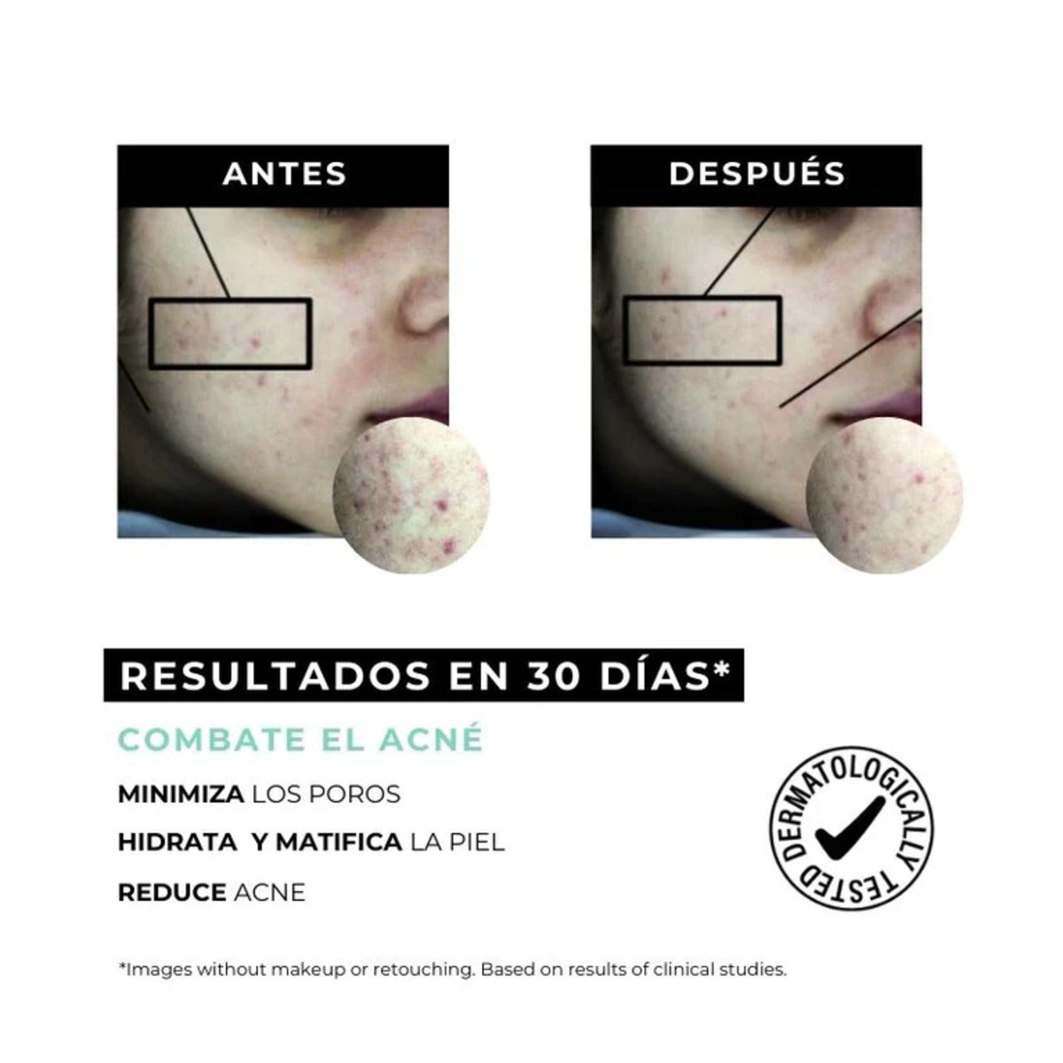 Krem przeciwtrądzikowy do skóry tłustej Equilibrium Arganour 30 ml