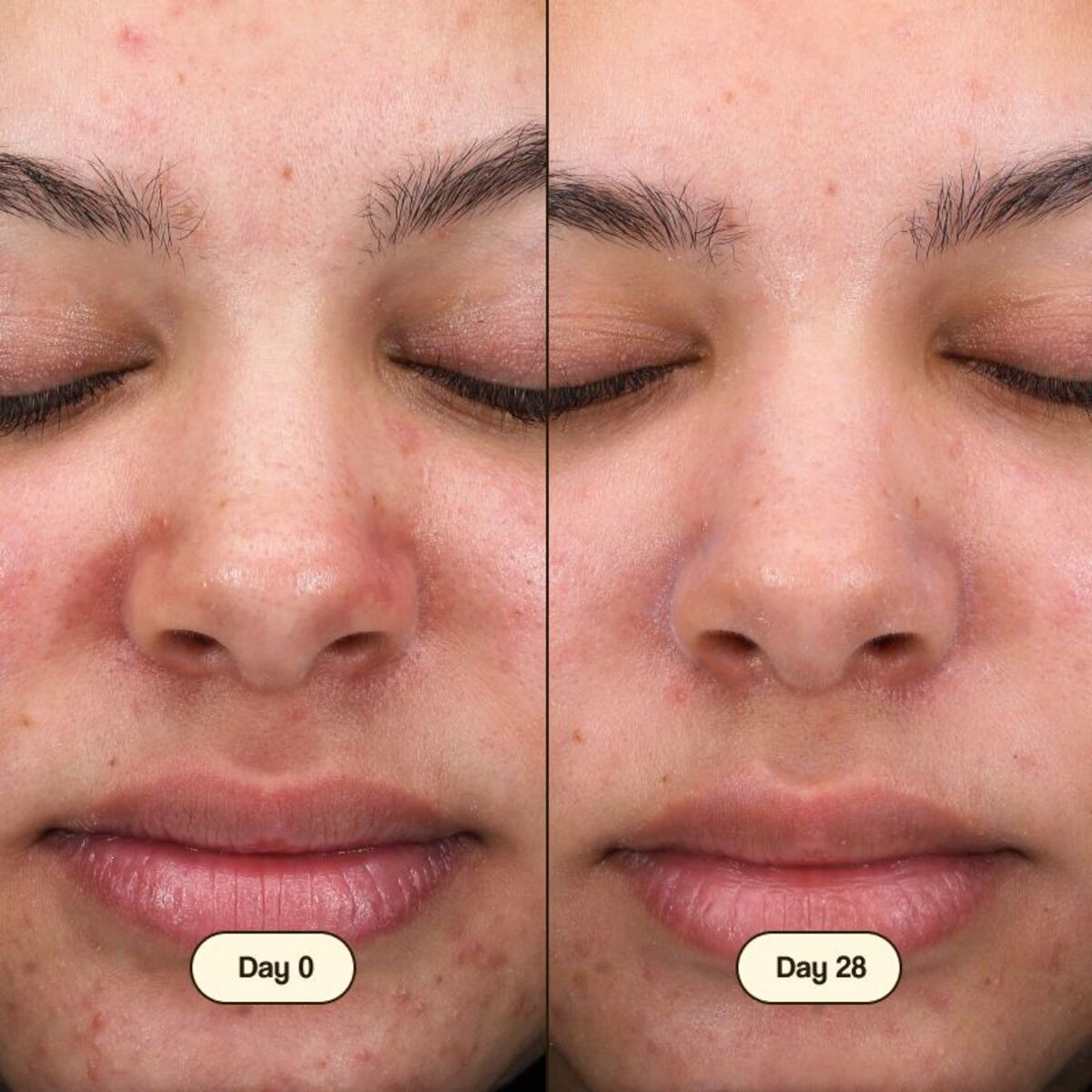 Gesichtsreiniger Salicylic Fresly 100 ml