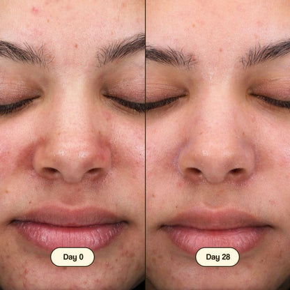 Gesichtsreiniger Salicylic Fresly 100 ml